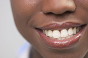 Teeth Whitening Course Miami